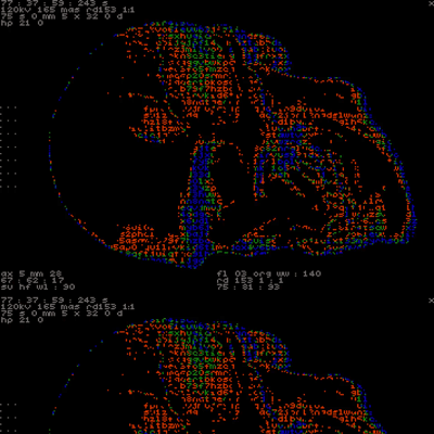 bloomberg, ransomware